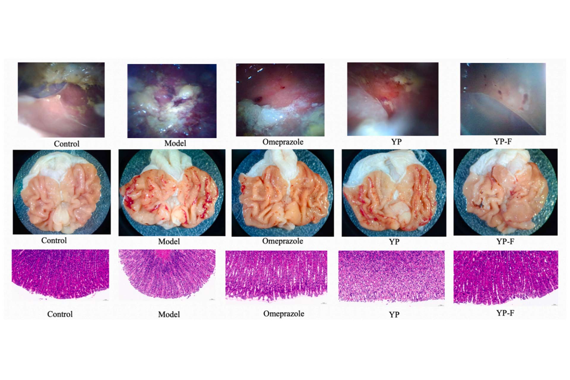 the-gastroscopy-results.jpg